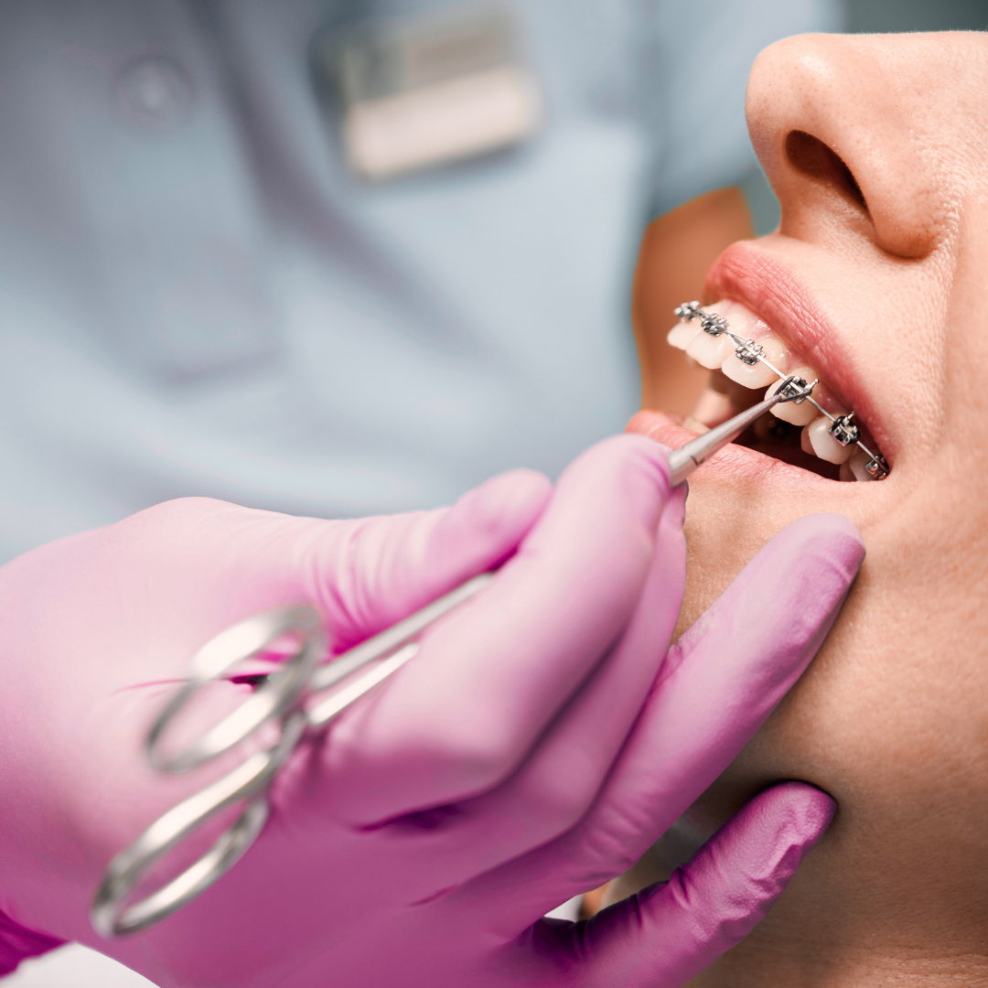 orthodontics